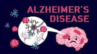 Alzheimers Disease The Basics  Being Patient [upl. by Evadne]