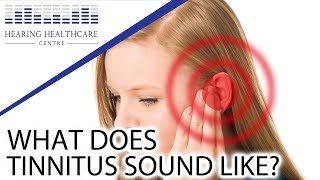 What Does Tinnitus Sound Like [upl. by Breanne]