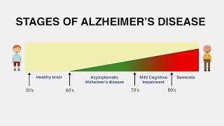 Diagnosing Alzheimer’s Disease [upl. by Aubrey]