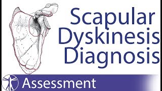 Diagnosing Scapula Dyskinesia [upl. by Aerdnna]