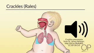 Respiratory Assessment by B Leary L DelSignore  OPENPediatrics [upl. by Attenod]