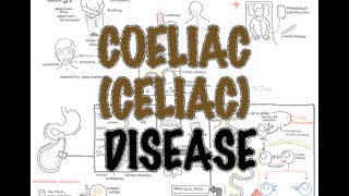 Coeliac Celiac Disease  Overview signs and symptoms pathophysiology diagnosis treatment [upl. by Ancier876]