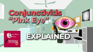 Conjunctivitis Pink Eye Explained [upl. by Aneez]