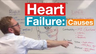 Heart Failure Causes [upl. by Harts]