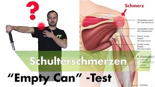 Schulterimpingement Testen  Supraspinatussehne Entzündet [upl. by Anola]