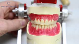 How Dentures Are Made [upl. by Faunie]