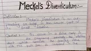 ulcerative colitis and Meckels diverticulum [upl. by Carlyn]