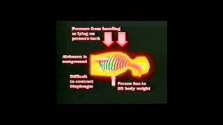 Positional Asphyxia [upl. by Immot490]