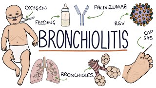 Understanding Bronchiolitis [upl. by Eecram]